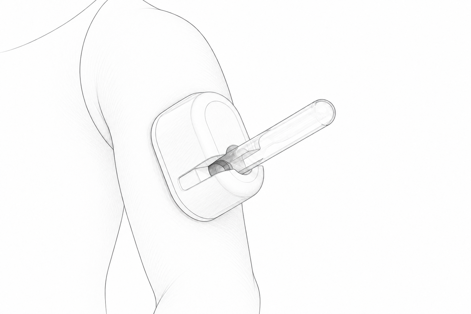 Ilustración del dispositivo adherido a la parte superior del brazo, con el tubo de recogida sobresaliendo hacia afuera.